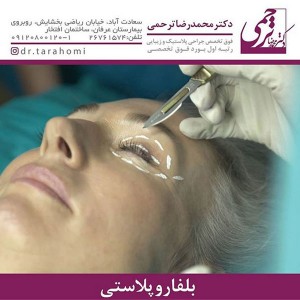 بلفاروپلاستی