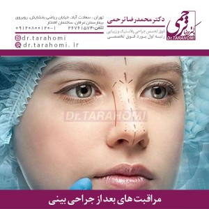 مراقبت های بعد از جراحی بینی