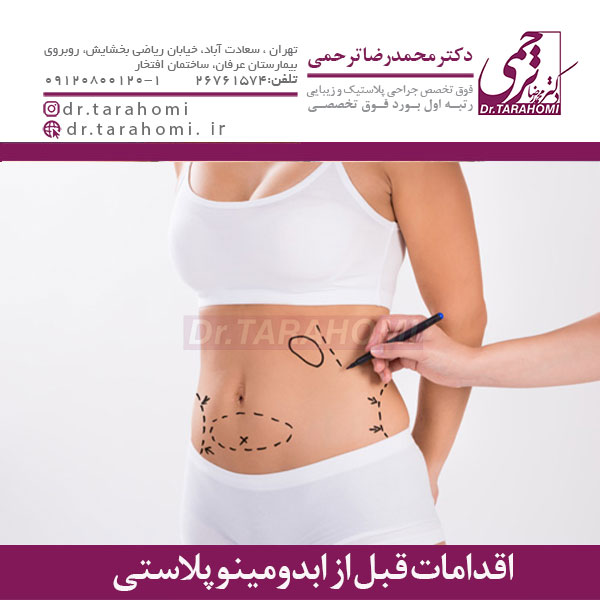 اقدامات قبل از ابدومینوپلاستی