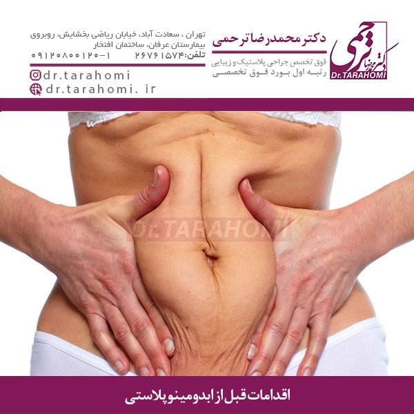 اقدامات قبل از ابدومینوپلاستی