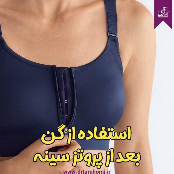 گن بعد از پروتز سینه - دکتر محمدرضا ترحمی