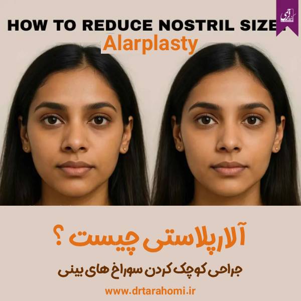 آلارپلاستی - دکتر محمدرضا ترحمی
