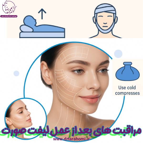 مراقبت های بعد لیفت صورت - دکتر محمدرضا ترحمی