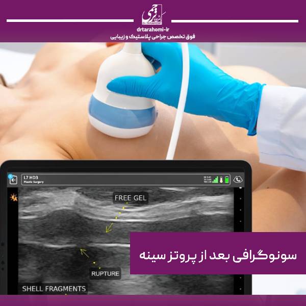 سونوگرافی بعد از پروتز سینه